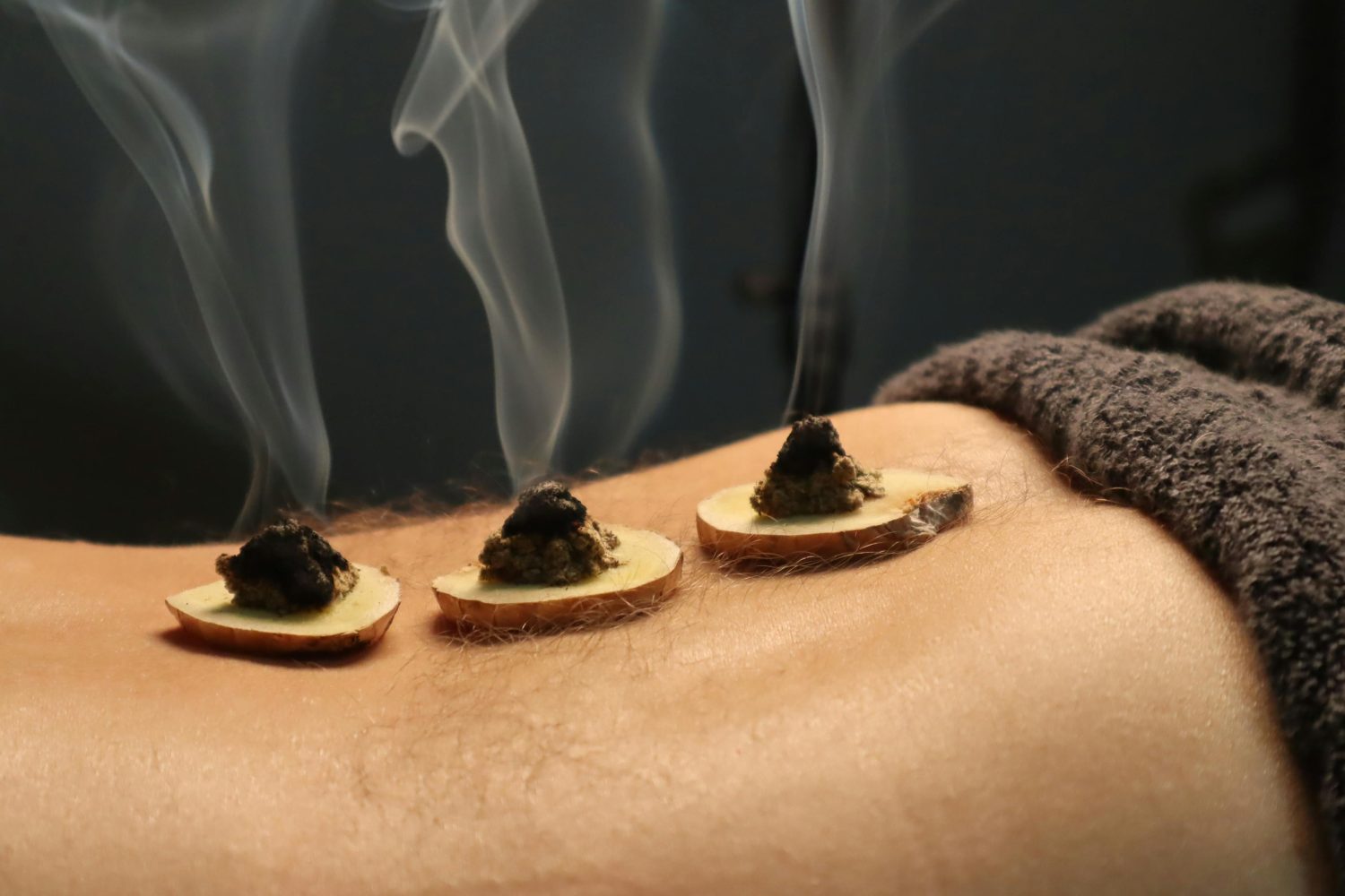 Moxibustion Session, Lingtai