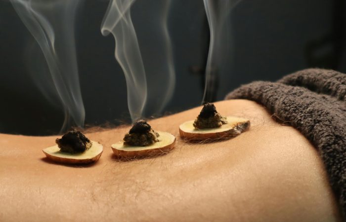 Moxibustion Session, Lingtai